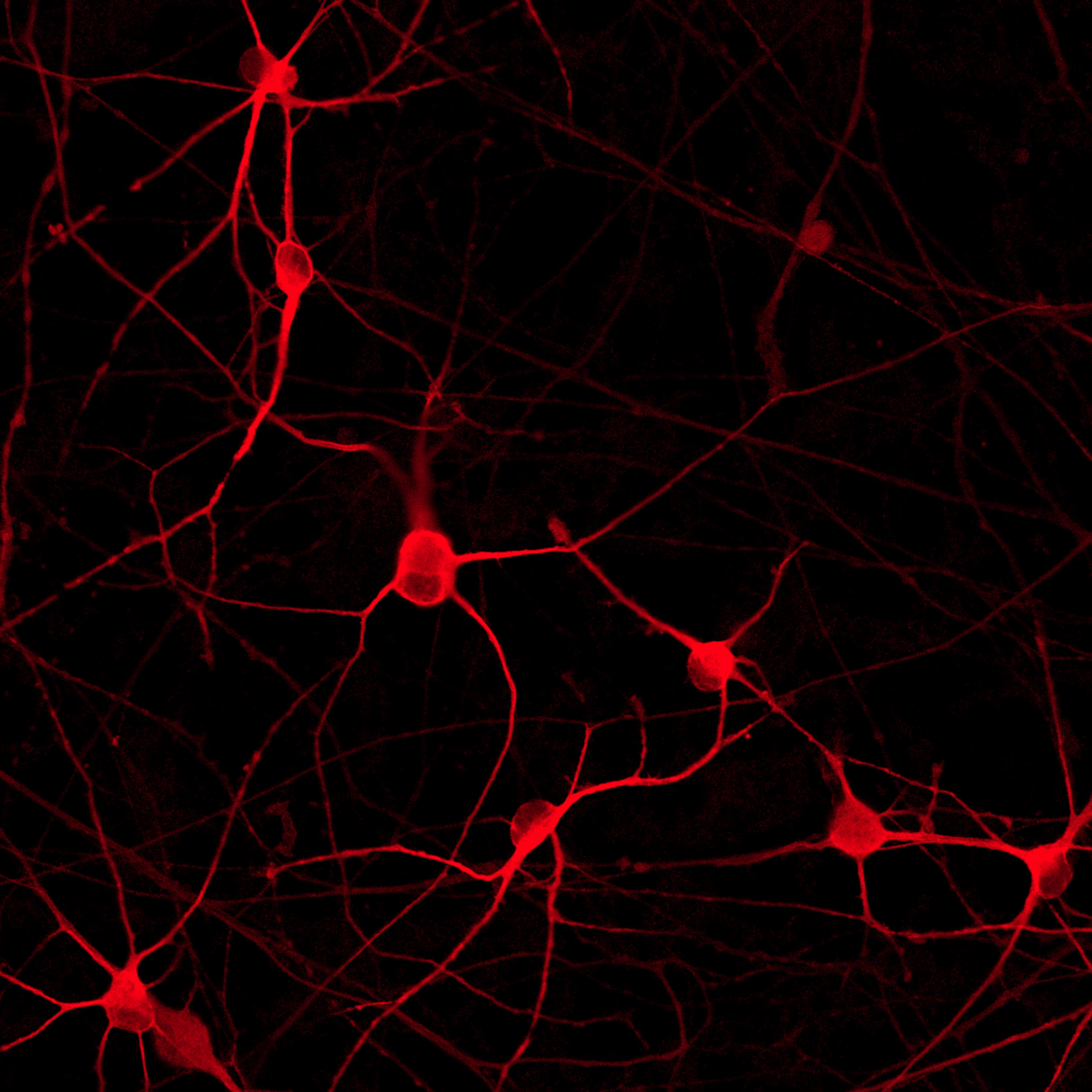 ioGlutamatergic Neurons PRKN R275W heterozygous | ioCells | bit.bio